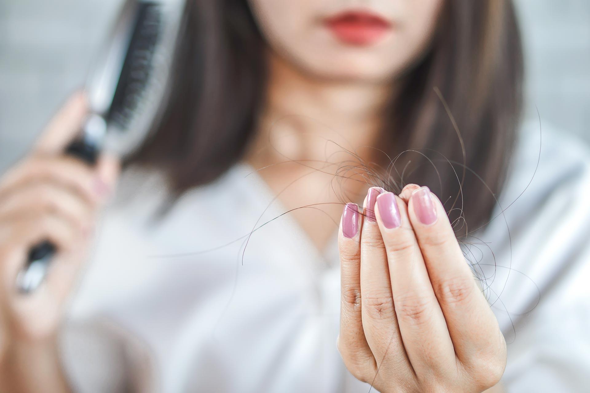 Alopecie