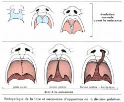 Bec de lievre 2