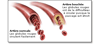 Cholesterol