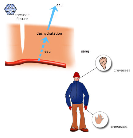 fissures, crevasses : symbolique, causes psychosomatiques, émotionnelles