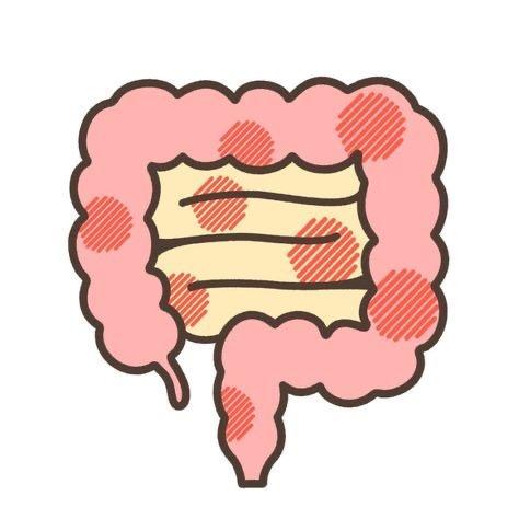 Symbolique de la maladie de crohn selon la LPE