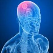 Meningite 1
