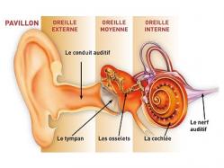 Oreille otite