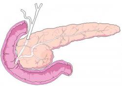 Pancreas