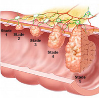 Polypes 2