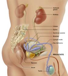 cancer prostate cause psychologique denas terapia pentru prostatita