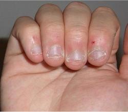 Ronger ongles 1