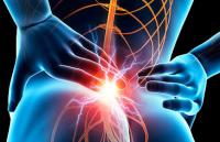 Sciatique signification
