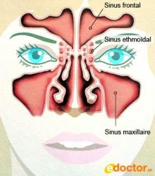 Sinus